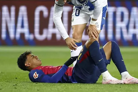 برشلونة يصدم الاتحاد الإسباني بشأن إصابة لامين يامال.. ماذا حدث؟